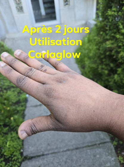 Carlaglow blanchissant est pour tout type peau