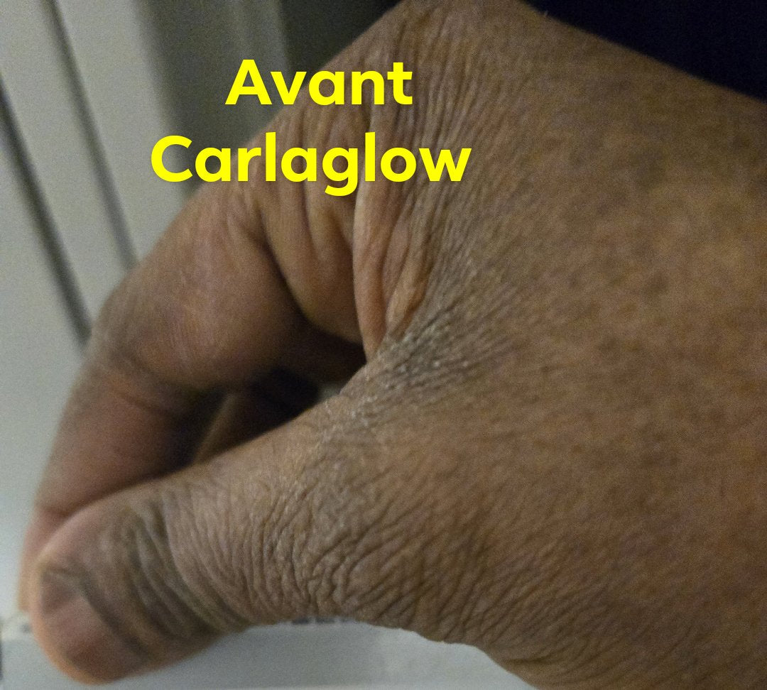 Carlaglow blanchissant est pour tout type peau