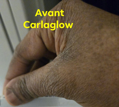 Carlaglow blanchissant est pour tout type peau